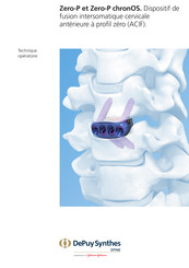 Johnson & Johnson DePuy Synthes Zero-P Mode D'emploi